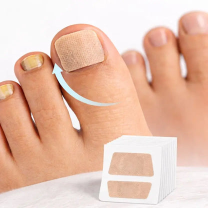 Adesivo para Unhas | Fungos e Unhas Encravadas | 32 Un - imagem 1