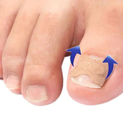 Adesivo para Unhas | Fungos e Unhas Encravadas | 32 Un - imagem 4