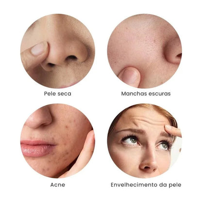Massageador Elétrico Facial com Radiofrequência | Lifting em Casa - imagem 4