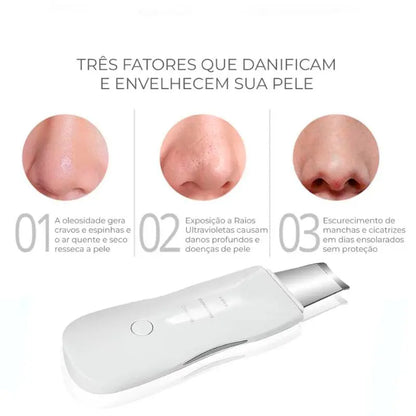 Peeling Ultrassônico | Limpeza Facial - imagem 7