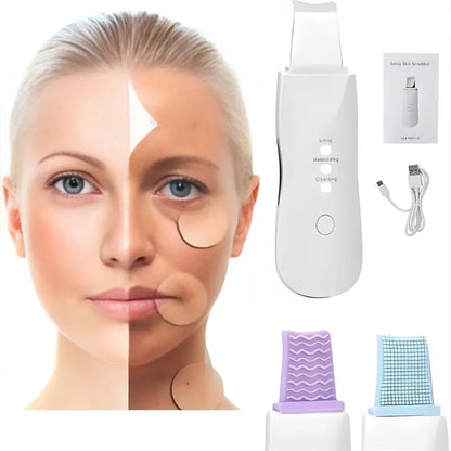 Peeling Ultrassônico | Limpeza Facial - imagem 3