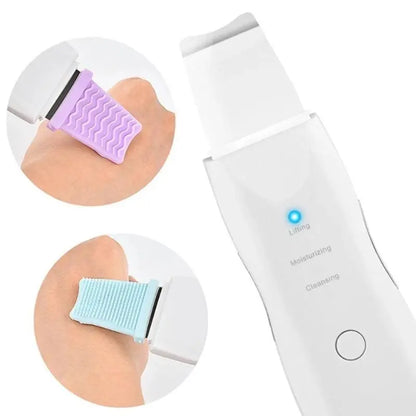 Peeling Ultrassônico | Limpeza Facial - imagem 4
